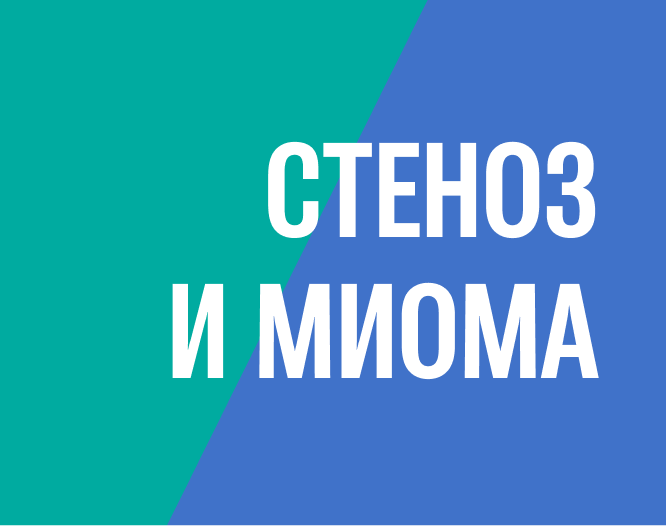 Удаление субмукозной миомы и полипа в менопаузе без наркоза