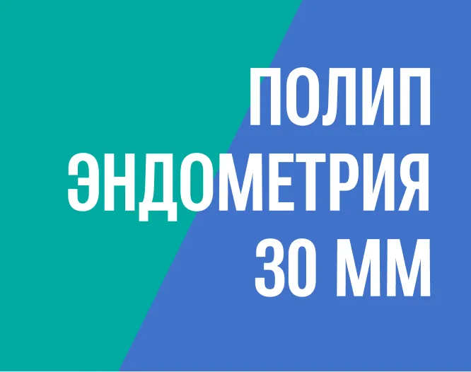 Удаление крупного полипа матки путём офисной гистероскопии без госпитализации и без наркоза