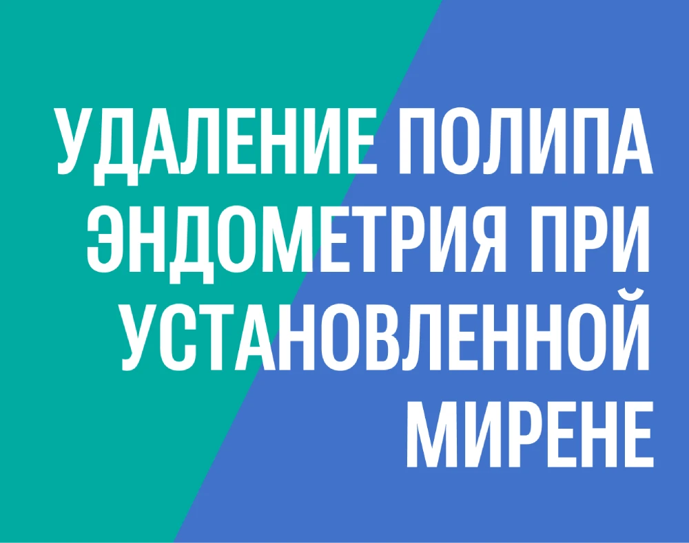 Удаление полипа эндометрия при установленной Мирене
