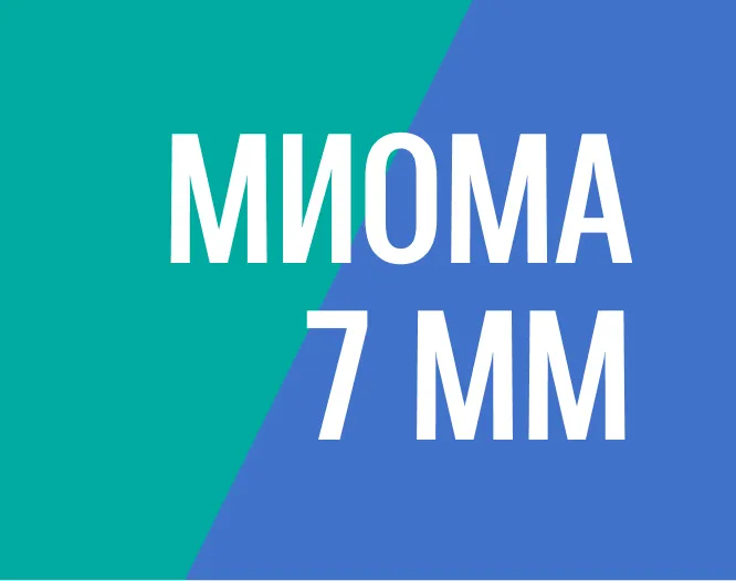 Удаление подслизистой миомы путём офисной гистероскопии без госпитализации, без наркоза