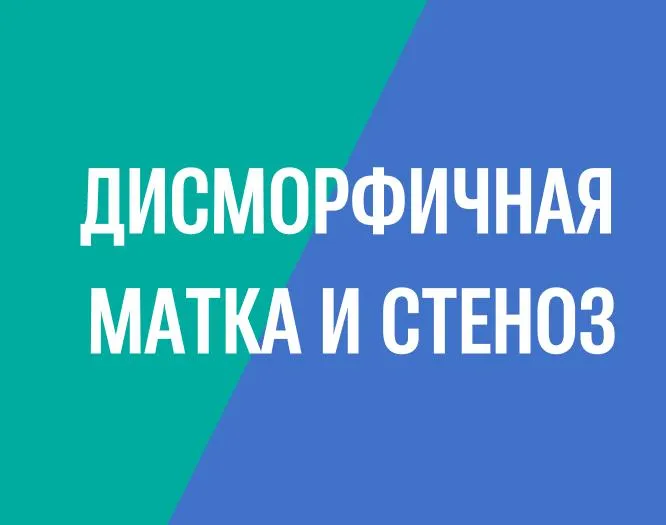Устранение стеноза шейки матки и коррекция дисморфичной матки