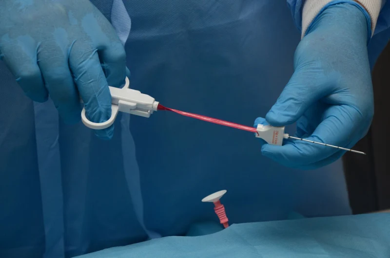 Биопсия шейки матки у хирурга-гинеколога Дмитрия Прыня в Краснодаре