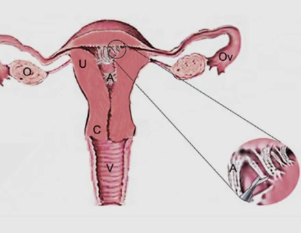 Диагностика внутриматочных синехий у врача Дмитрия Валерьевича Прыня в Краснодаре