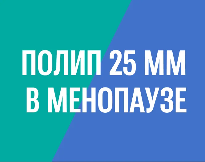 Удаление полипа матки в менопаузе без наркоза при офисной гистероскопии