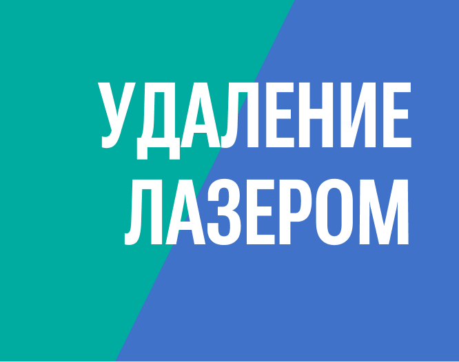 Удаление полипа в матке лазером без наркоза