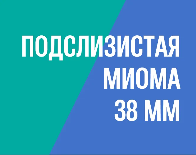 Удаление подслизистой (субмукозной) миомы при офисной гистероскопии