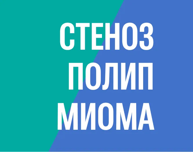 Стеноз ц/канала + полип эндометрия + субмукозная миома матки - возможности офисной гистеросокпии