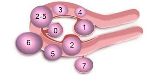 Миомы по FIGO.jpg