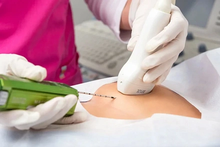 Трепан-биопсия