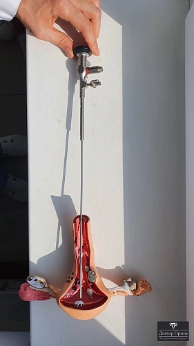 Демонстрация введения гистероскопа в полость матки на модели — офисная гистероскопия без наркоза