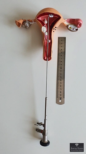 Гистероскоп на анатомической модели матки — иллюстрация офисной гистероскопии