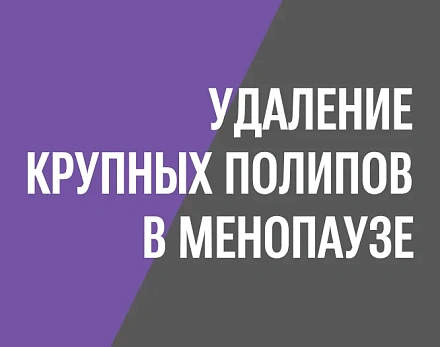 Практика: удаление крупных полипов в менопаузе, врач Дмитрий Валерьевич Прынь