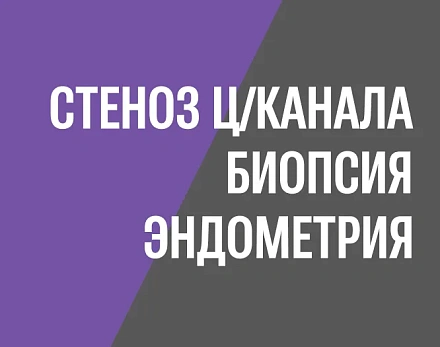 Практика: устранение стеноза цервикального канала и биопсия эндометрия без наркоза, врач Дмитрий Валерьевич Прынь