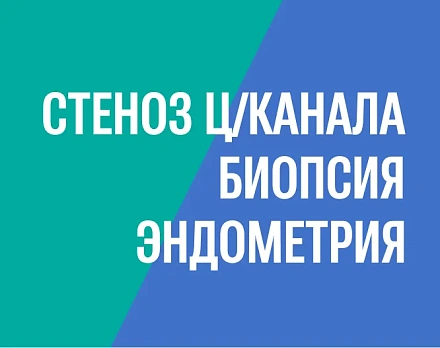 Практика: устранение стеноза цервикального канала и биопсия эндометрия без наркоза, врач Дмитрий Валерьевич Прынь