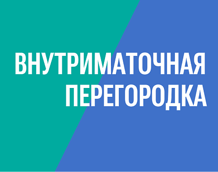 Рассечение внутриматочной перегородки при офисной гистероскопии без наркоза
